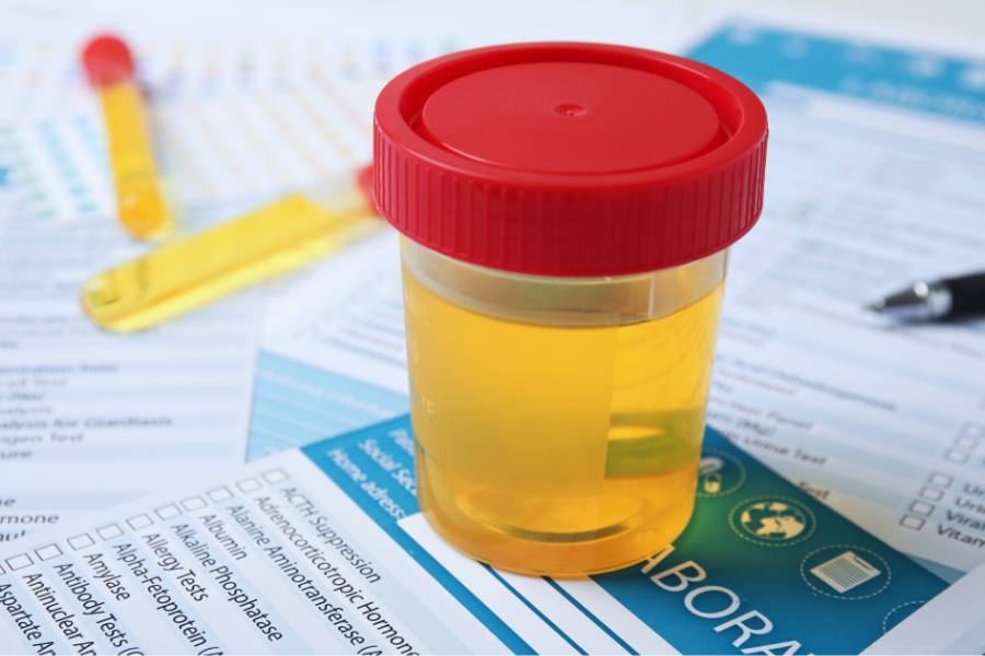 Failed DISA drug test concept pic shows urinalysis cup