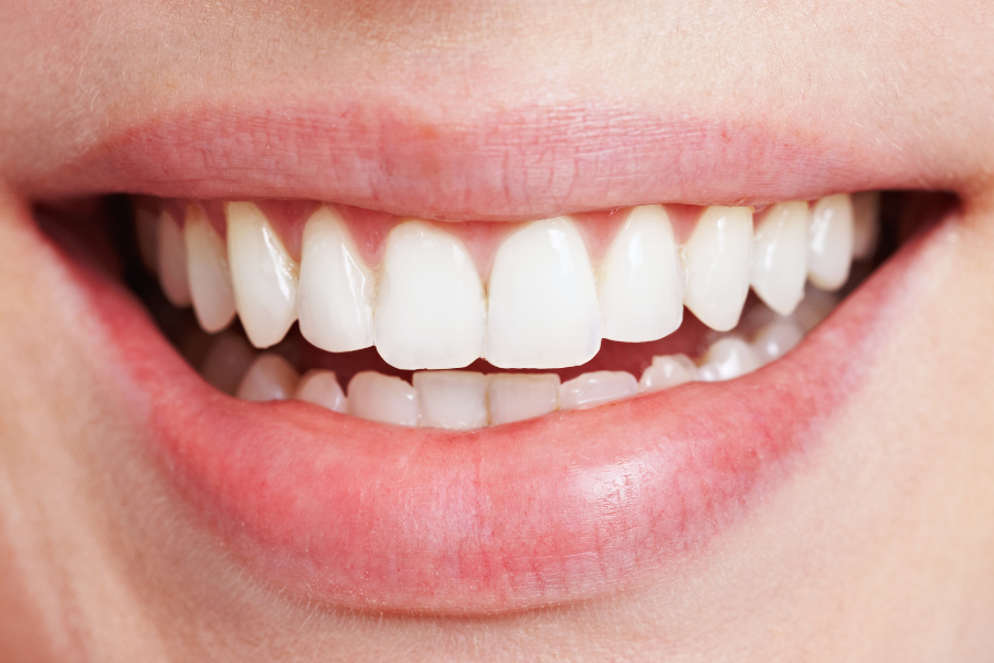 A healthy smile shows the concept of dental grants for alcoholics and addicts in recovery